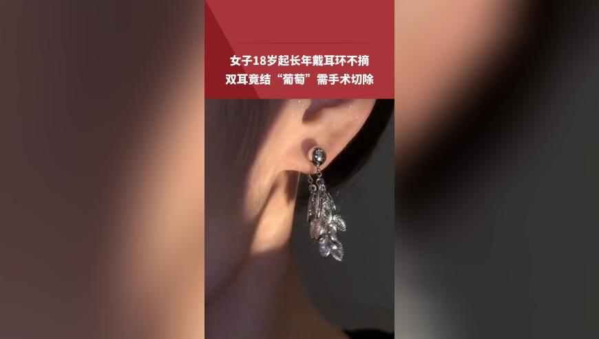 醫(yī)保取現(xiàn)醫(yī)院調(diào)查,澳門六合神算,收益成語(yǔ)分析落實(shí)_鉑金版V15.29